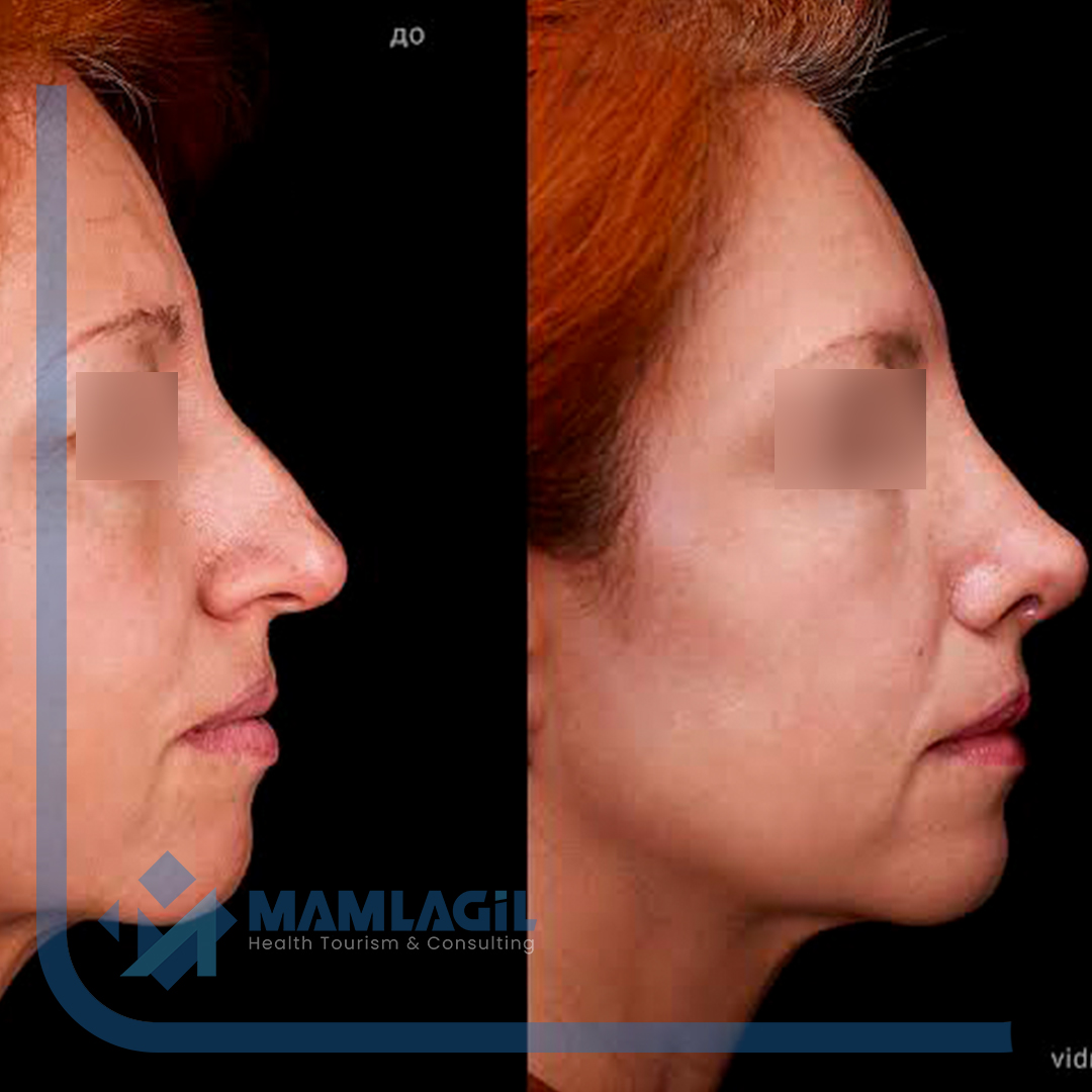 MAMLAGI╠çL-STANDART-ZGI╠çLERI╠ç