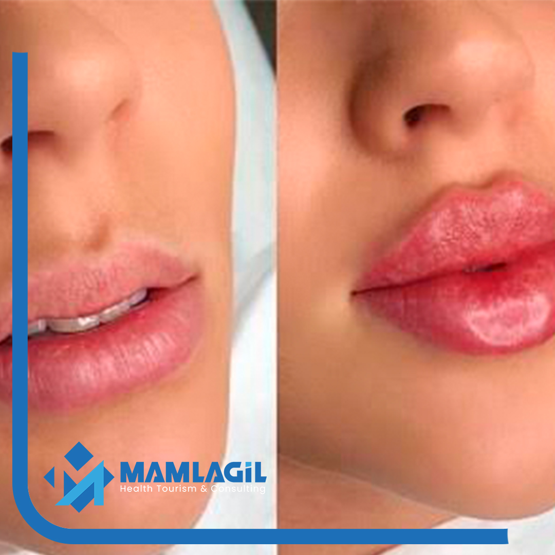MAMLAGI╠çL-STNDART-S╠ğABLON-C╠ğI╠çZGI╠çLERI╠ç