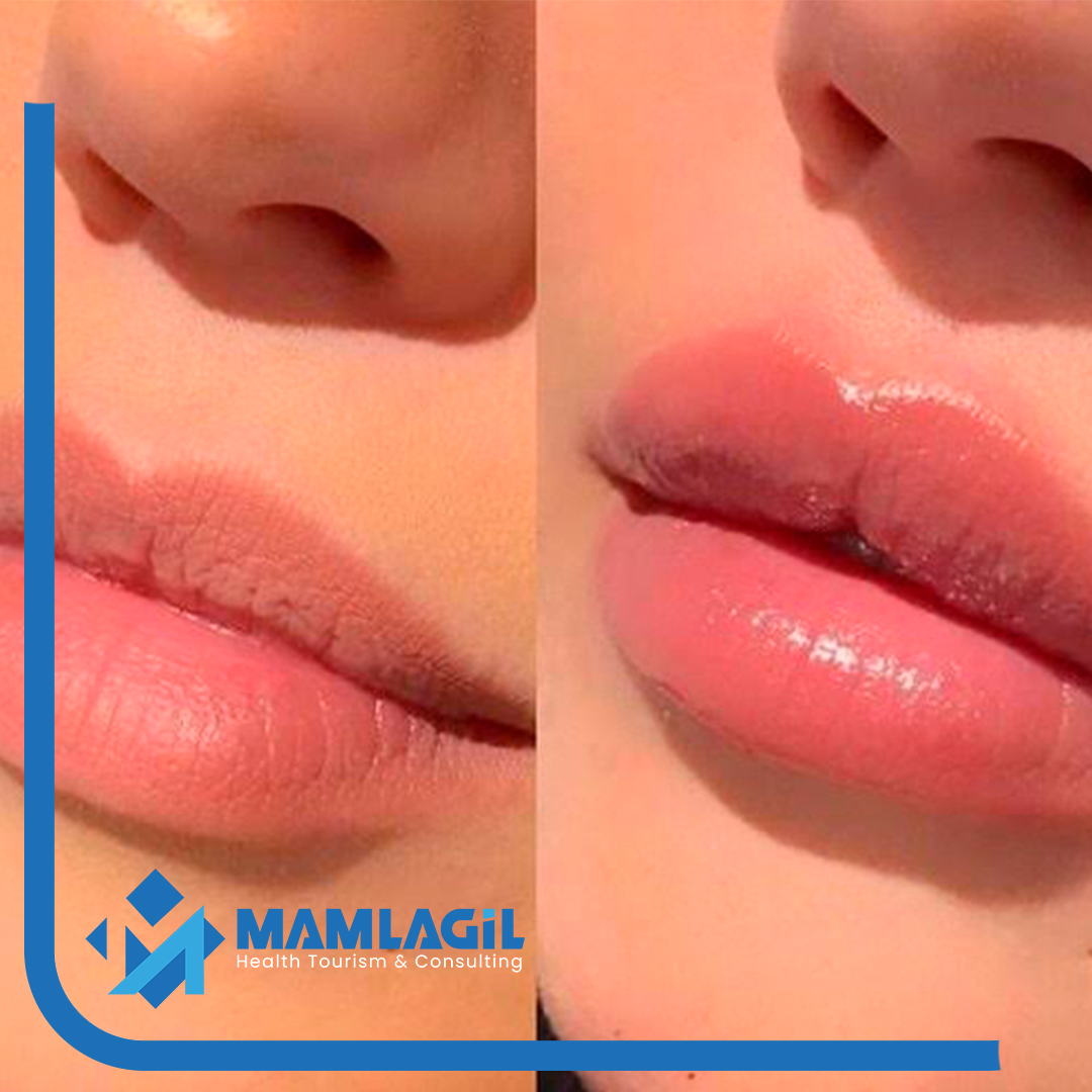 MAMLAGçL-STANDART-S╠ğABLON-C╠ğI╠çZGI╠çLERI╠ç